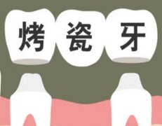 西安烤瓷牙会蛀吗？西安烤瓷牙怎么维护?